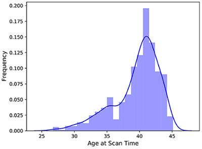 Accurate segmentation of neonatal brain MRI with deep learning